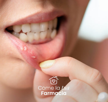 Afte in bocca? Ecco cosa fare